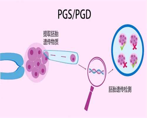供卵试管属于第几代试管婴儿技术？借卵代生带来生命新希望